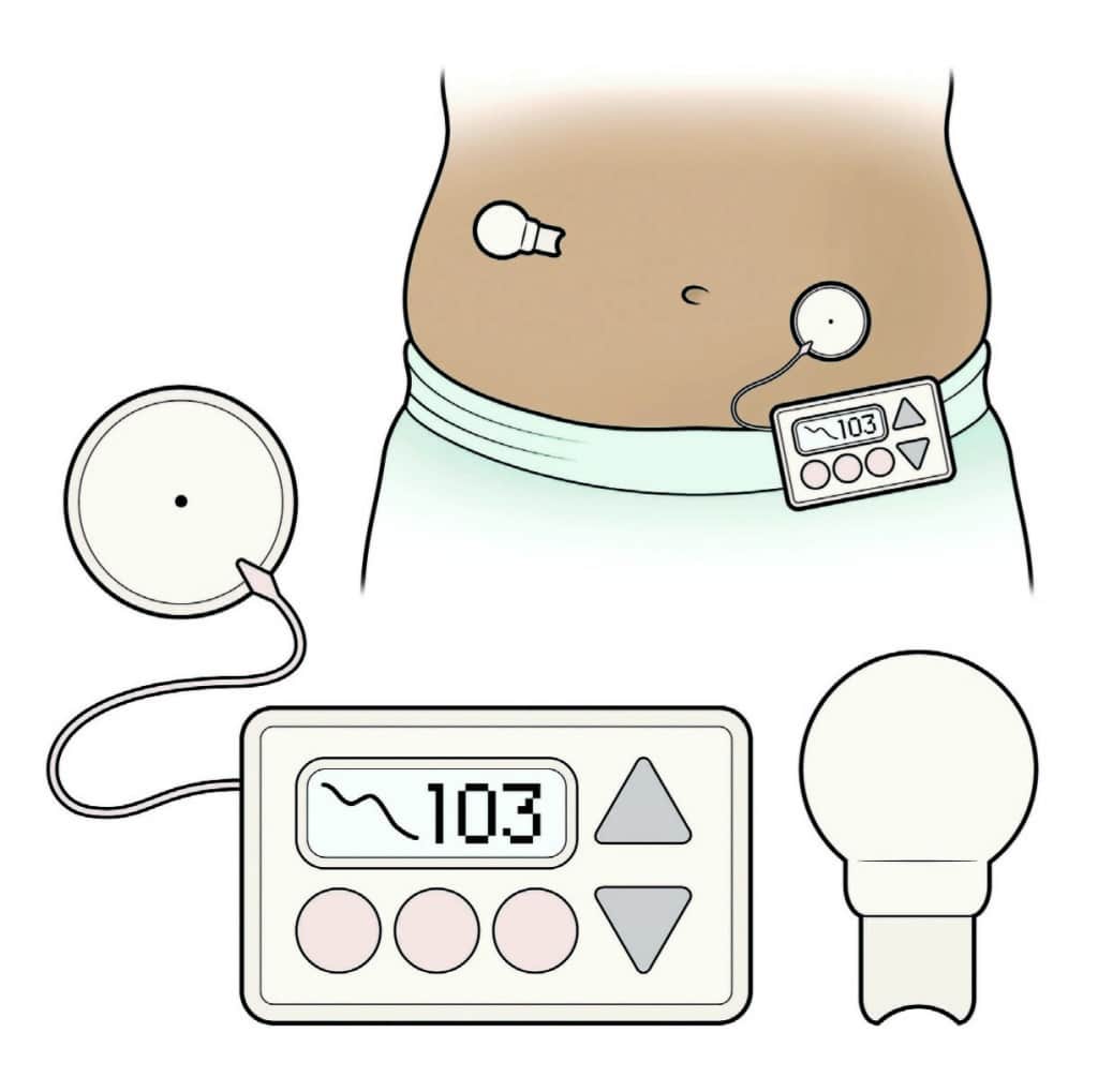 Image C/O Hormone.org