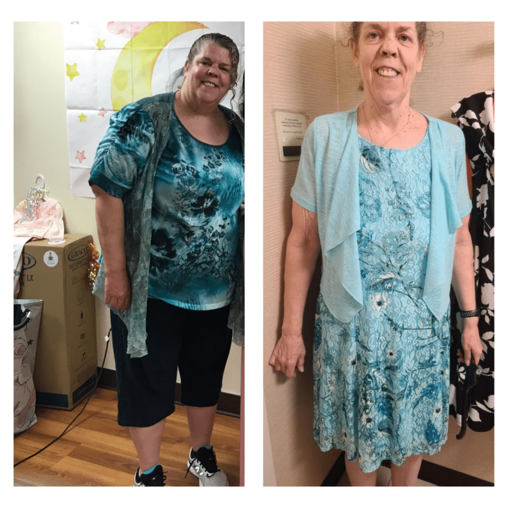 Teri's 150 lbs weight loss photo